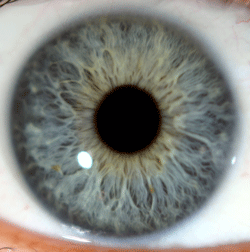 Main Iris Markings & Rings - Carahealth